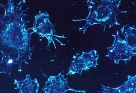 A Closer Look at Major Breast Cancer Therapy Options