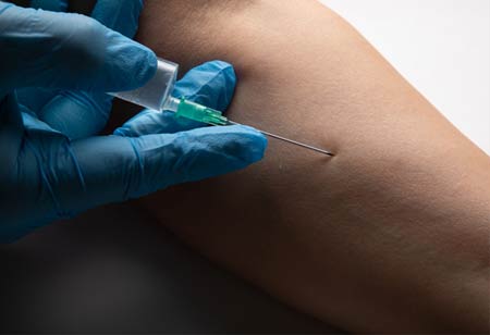 Sclerotherapy Unveiled: What You Need to Know for a Smoother Health Journey