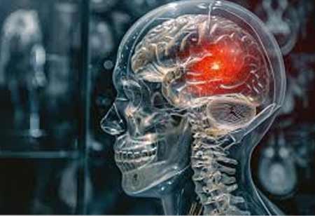 All about Brain Injuries and Concussions